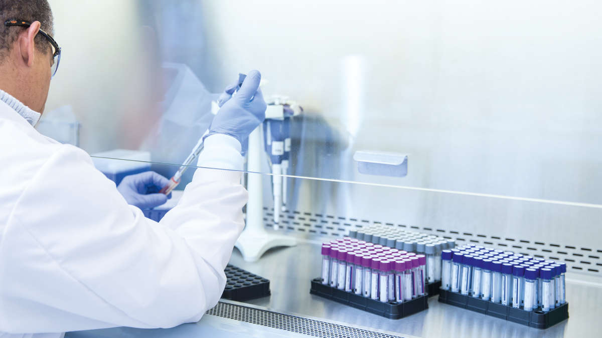 QuantiFERON-CMV, QF-CMV, blood handling, scientist