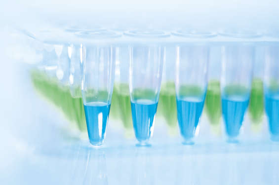 ADNA, PCR plate, qPCR, adding DNA the colored MasterMix is turning from blue to green, visual control of correct pipetting, cat. no. 208054 QuantiNova SYBR Green PCR Kits (500), cat. no.208254 QuantiNova Probe PCR Kits (500) 05/2013, (PCR, Spin/Tube/Plate, Photography, Applications DNA (ADNA))