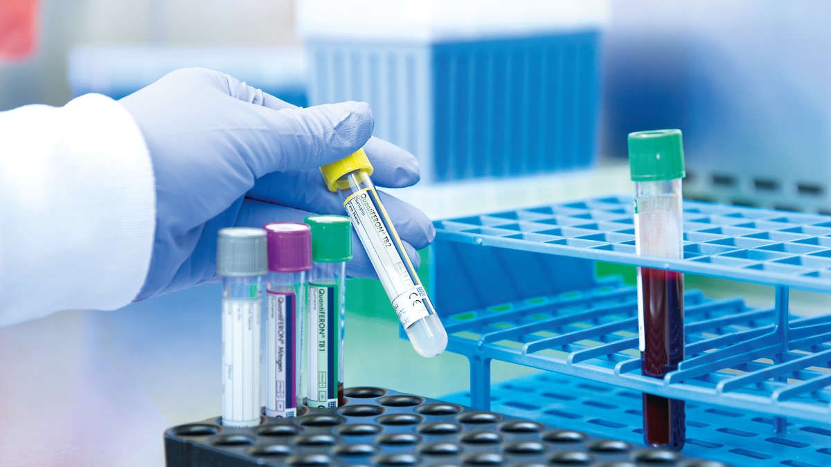 QFT-Plus, QuantiFERON-TB Gold Plus, laboratory, tubes, workflow