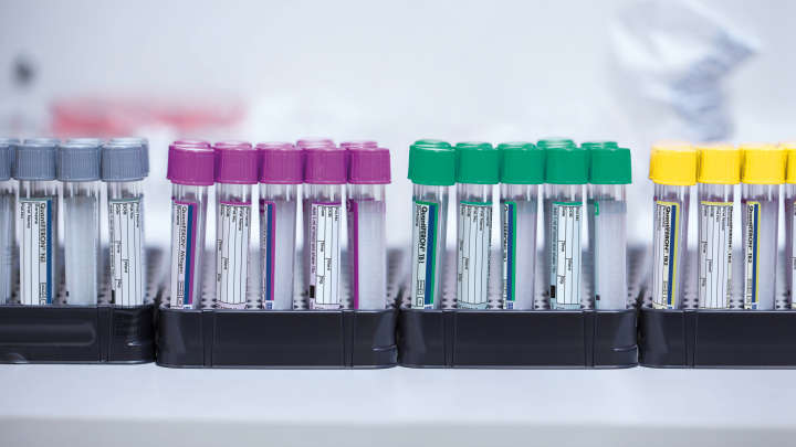 QFT-Plus, QuantiFERON-TB Gold Plus