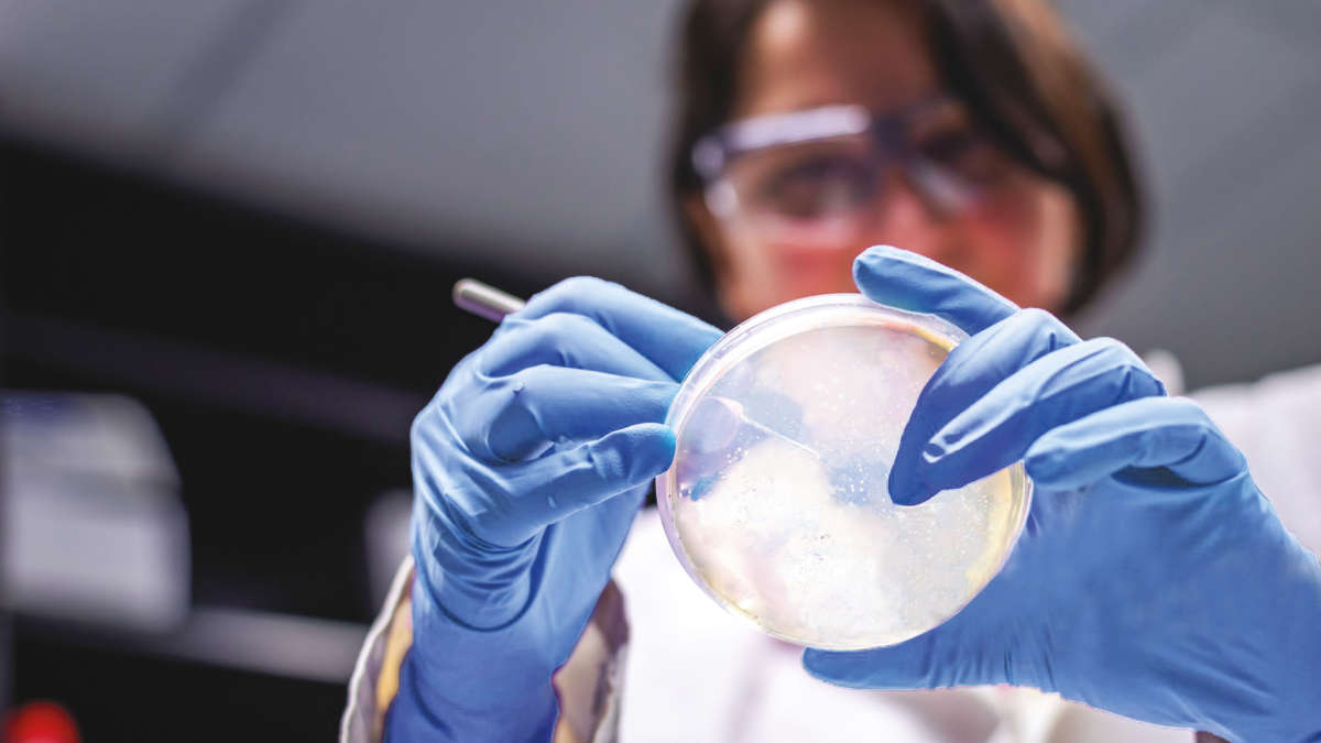 Microbial detection