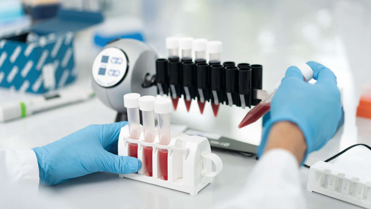 Liquid Biopsy