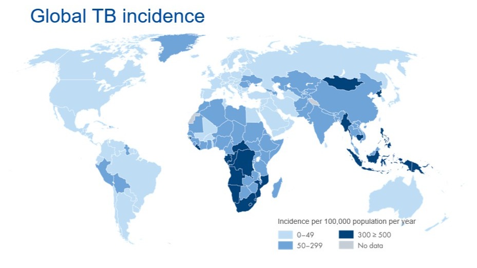 tuberculosis is a global concern