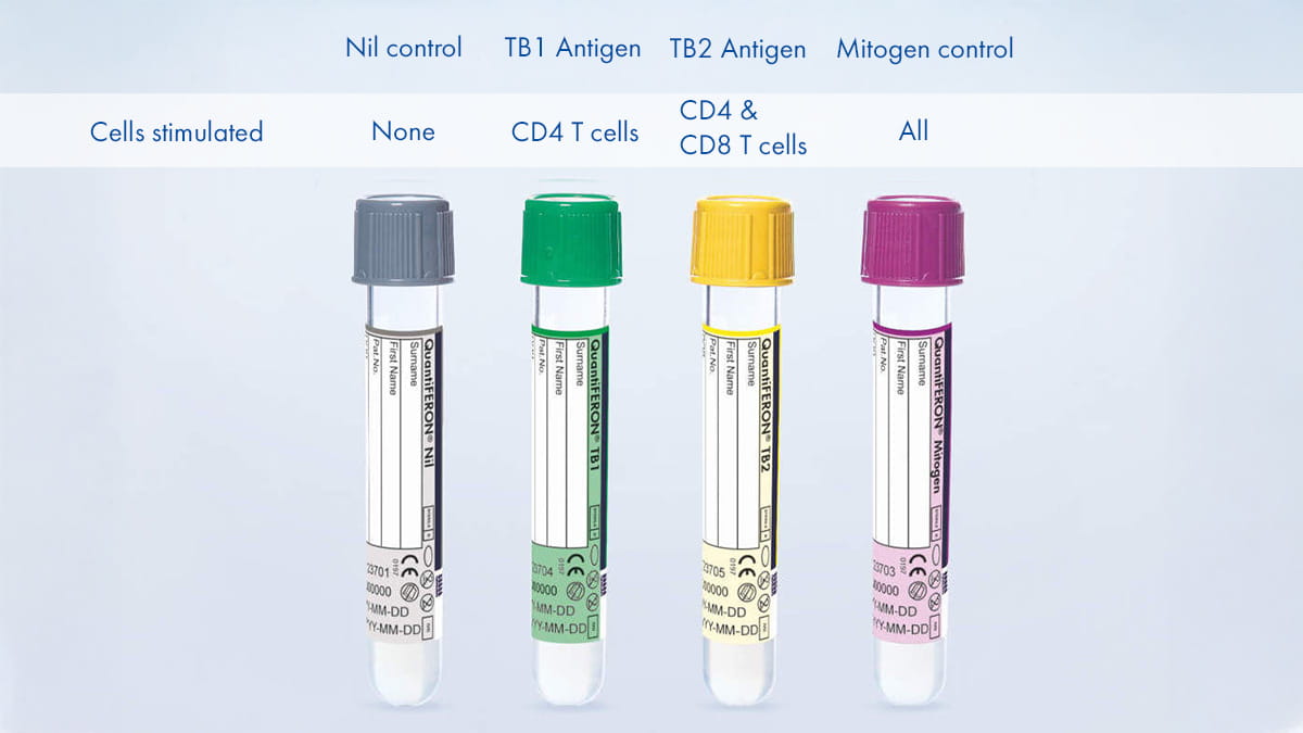 How does QuantiFERON-TB Gold Plus use CD8 T-cell technology