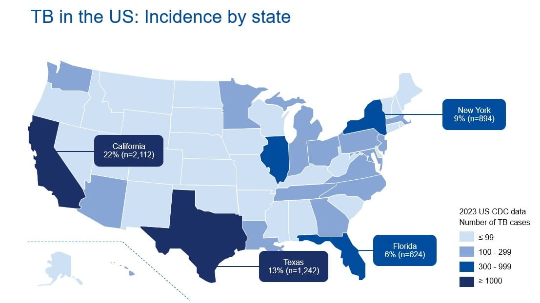 tuberculosis in the United States