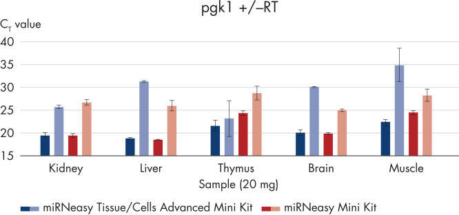 miRNeasy Tissue/Cells Advanced Kits | microRNA Prep | QIAGEN