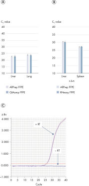 AllPrep DNA/RNA FFPE Kit | DNA and RNA Extraction | QIAGEN