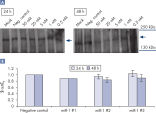 Downregulation at protein level after miR-1 mimic transfection.