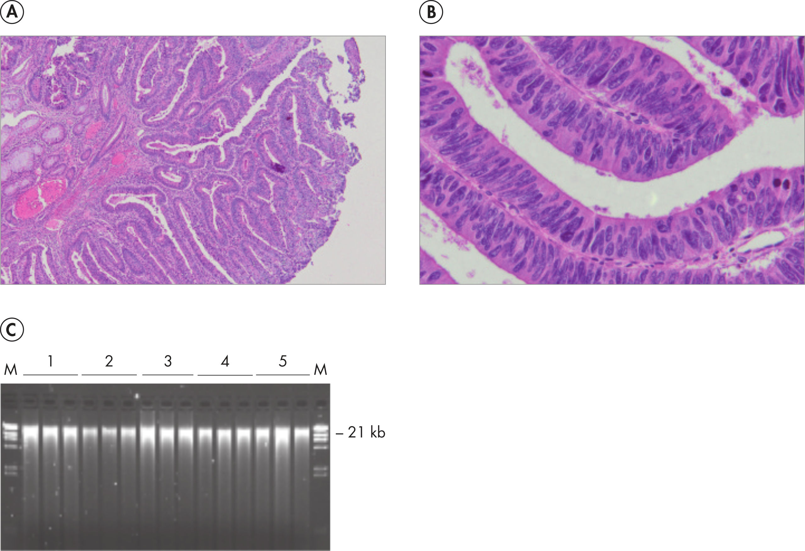 PAXgene Tissue DNA Kit