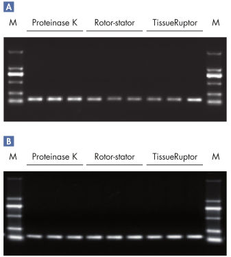 michiアライヴン ポレーション アライヴン アントワ ウルトラパルスポレーション : サンキュー