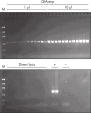 Laser microdissection PCR.