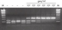 High performance of purified nucleic acids in downstream analyses.