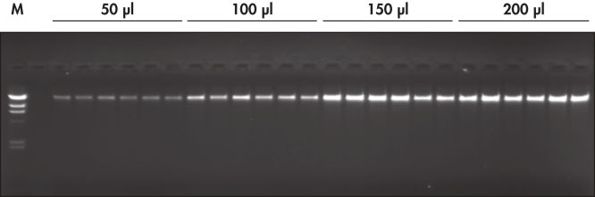 Agarose gel of purified genomic DNA.