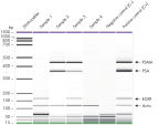 AdnaTest ProstateCancerDetect results of samples analyzed with an Agilent 2100 Bioanalyzer