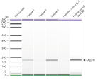 AdnaTest EMT-2/StemCellDetect results of samples using an Agilent 2100 Bioanalyzer: Tumor stem cell-associated gene expression