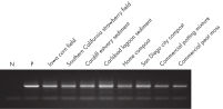 Figure 3. DNeasy PowerMax Soil Kit isolated total genomic DNA.