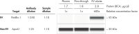 EV protein analysis across plasma fractions using Simple Western automated western blot (ProteinSimple, a Bio-Techne Brand).