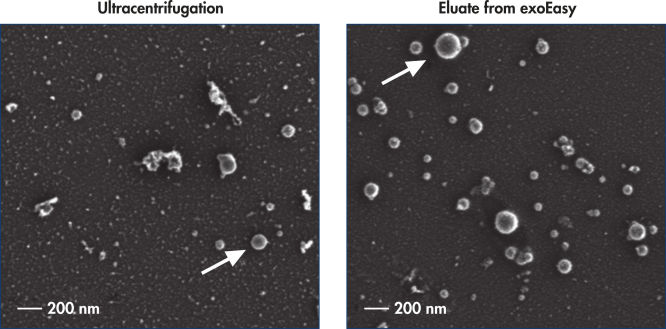 Intact vesicles are eluted from the exoEasy membrane with higher purity compared with ultracentrifugation.