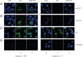 Detection of hsa-miR-127 and hsa-miR-154 by fluorescent in situ hybridization using miRCURY LNA detection probes in cryopreserved bone marrow cells from an acute myeloid leukemia patient.