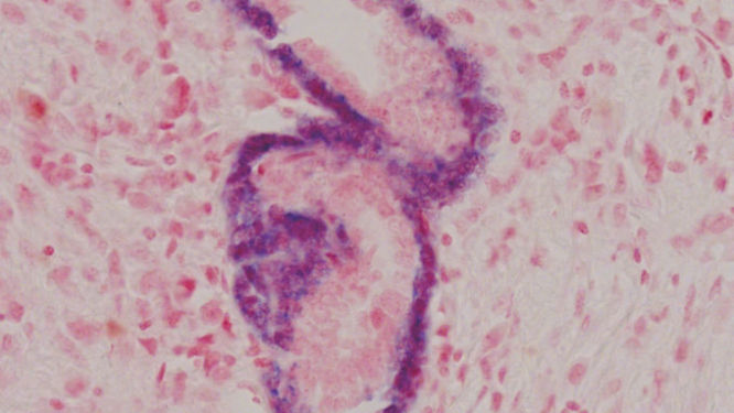 aminaseページ AM2288_650x600.jpg-250.jpg