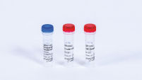 Terminal Deoxynucleotidyl Transferase (TdT)