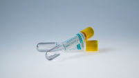 PAXgene Urine Liquid Biopsy Tube (50)