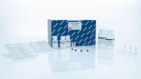 QIAamp Viral RNA Kits for RNA Extraction