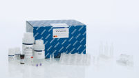 QIAamp Circulating Nucleic Acid Kit – cfDNA/cfRNA Isolation