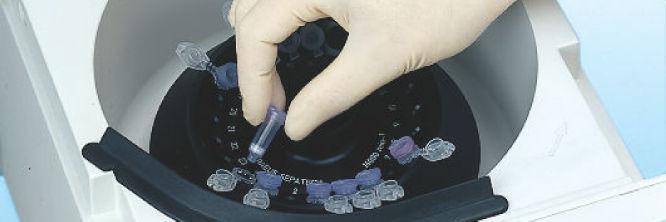 QIAquick Gel Extraction Kit | Gel DNA Extraction | QIAGEN