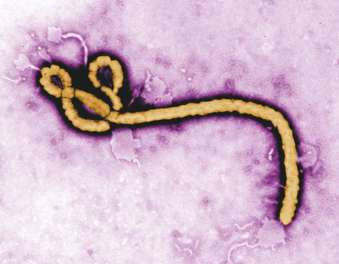 Ebolavirus detection