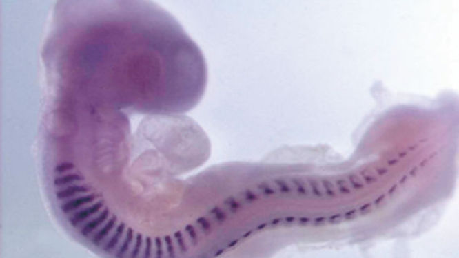 miRCURY LNA miRNA Detection Probes