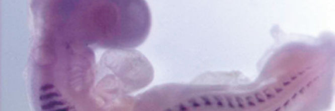miRCURY LNA miRNA Detection Probes