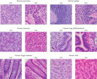 H&E staining with the PAXgene Tissue System gives results comparable to formalin-fixed tissue.